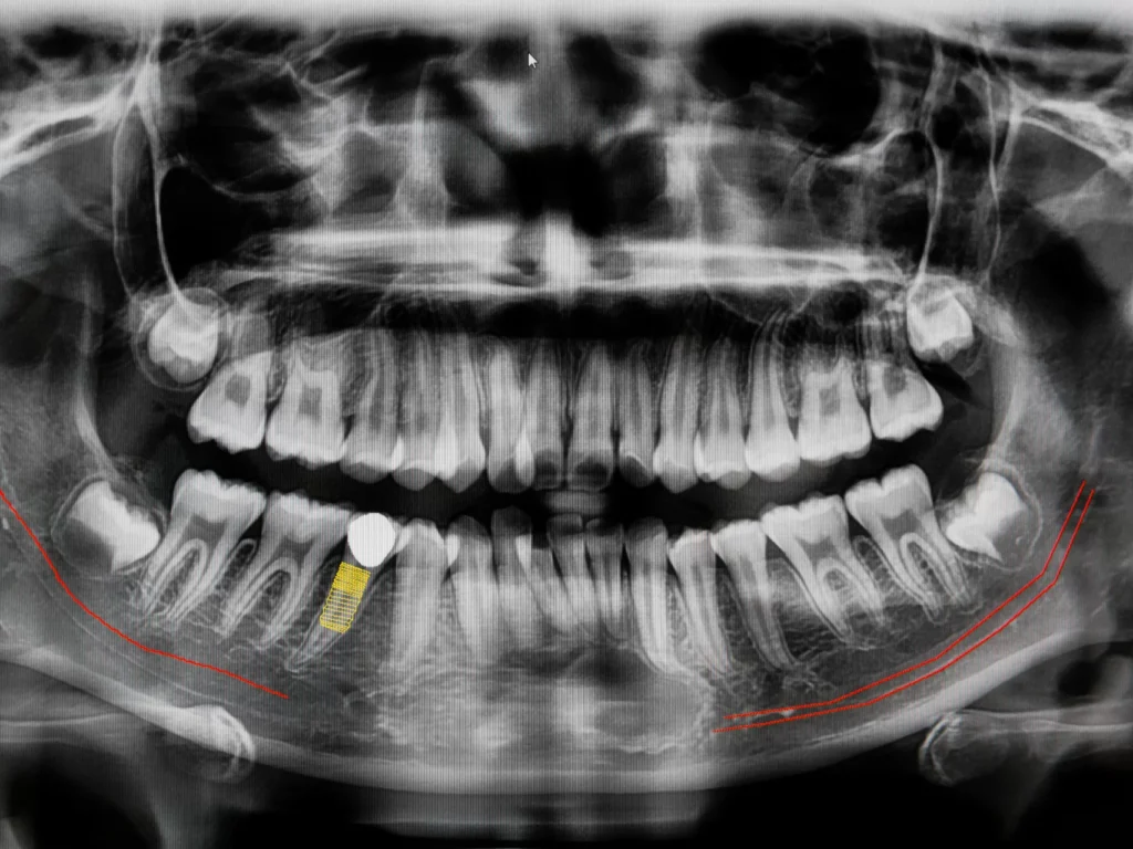 image of a digital X-ray